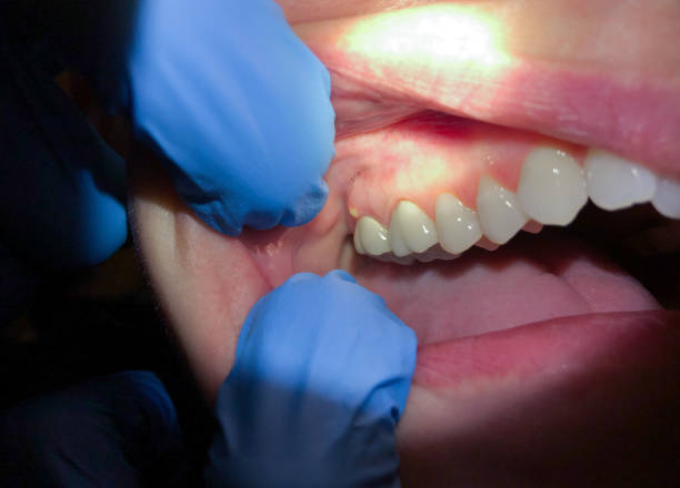 Best Teeth Whitening  in Lakewood, OH